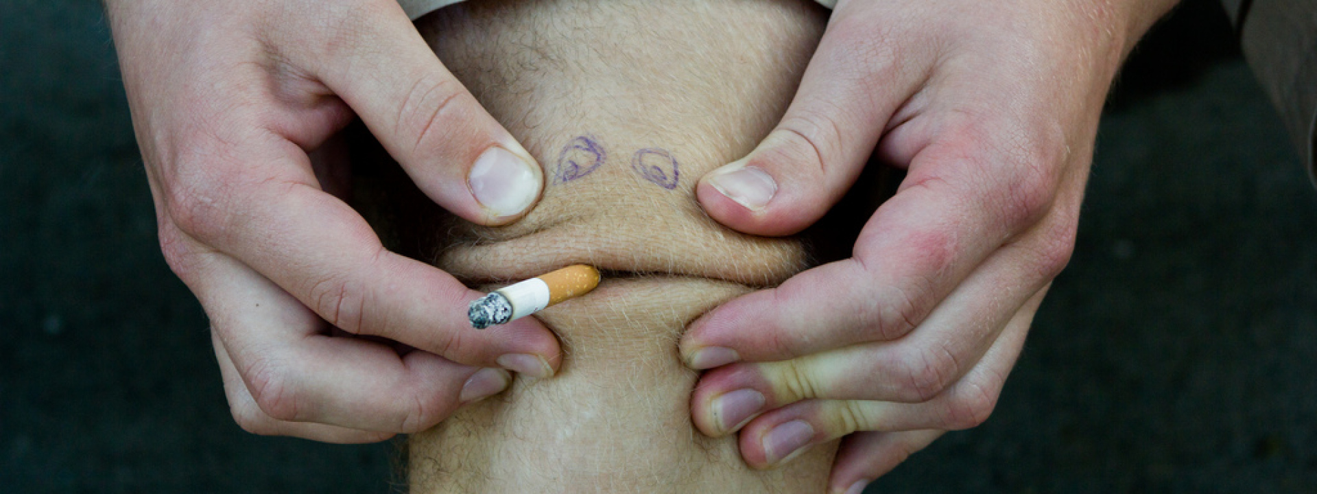 ひざこぞう c7f0fa5b42c1eaf761c0c8e0513da0